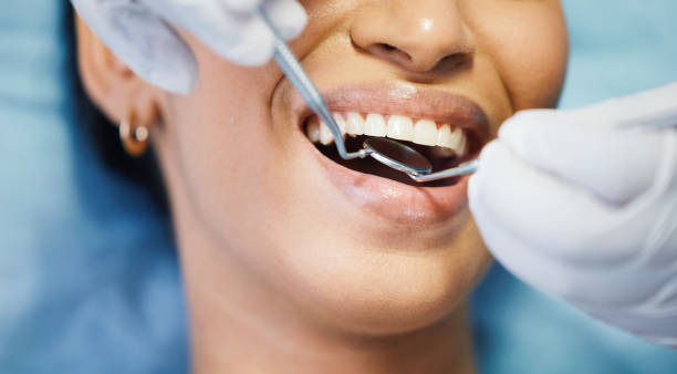 Best Emergency Root Canal Therapy in Rio Rancho, NM