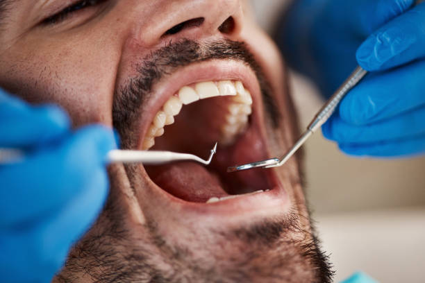 Best Emergency Treatment for Oral Infections in Rio Rancho, NM